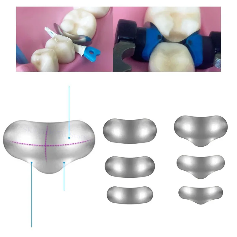 Nowe opaski dentystyczne przekrojowe wyprofilowane matryce metalowe M10 twardy klin dentystyczny kliny Tulwar z otworem plastikowy klin stomatologia