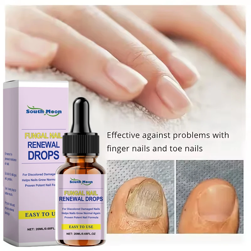 Nail Fungal Repair Serum Foot Toe Nail Fungus Removal Essential Oil Anti Infection Onychomycosis Paronychia Repairing Care