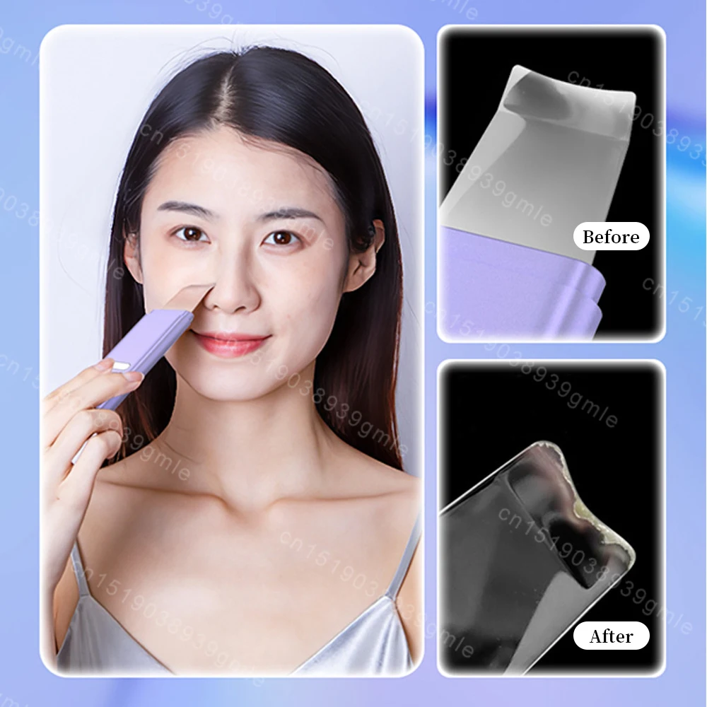 Ultrasonic Skin Scrubber Peeling Blackhead Remover Facial Shovel Cleanser Ultrasonic Ion Ance Pore Cleaner Deep Face Cleaning