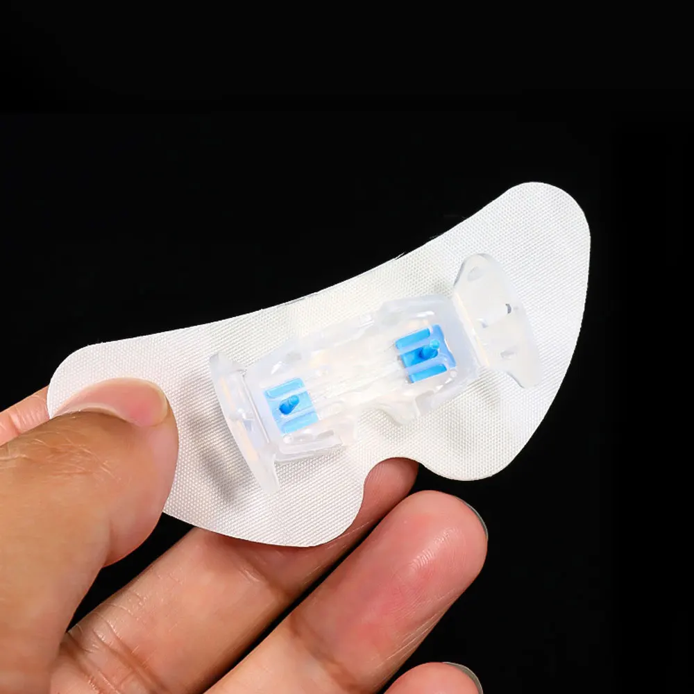 5/10/20pcs Catheter Fixation Universal Fixing Sticker Tape Leg Retainer Holder Drainage Tube Device Urine Nylon Bag Fixed