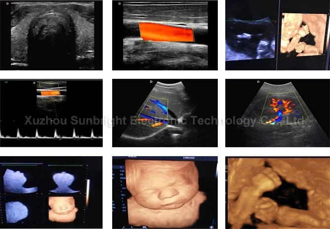 Sunbright ultrasound sun 906A 3d ecografo 4d color doppler ultrasound price