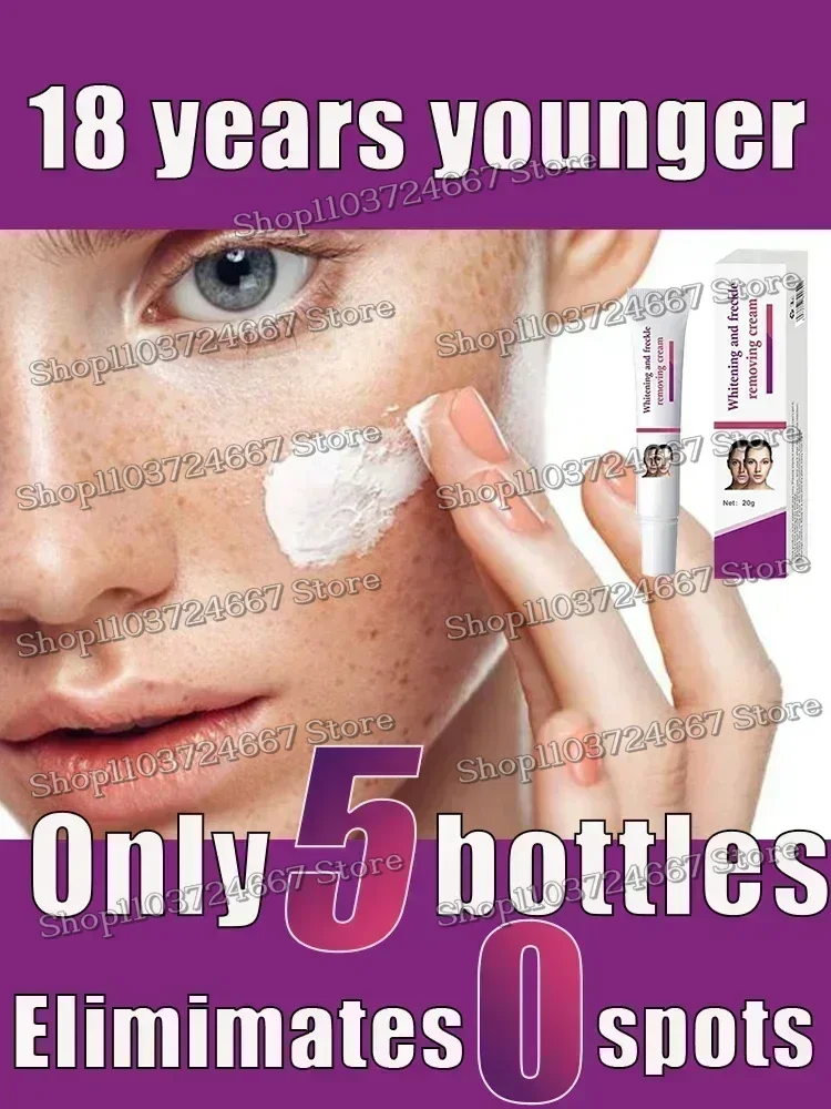 

Remove Dark Spots Whitening Freckle Effective Remove Melasma Melanin Moisturize Brighten Smooth Face Skin Care249679