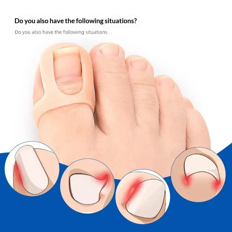 Ingrown Toenail Corrector Pads Ultra Thin Invisible Foot Care Patches for Daily Wear Shoes Sneakers Walking Use