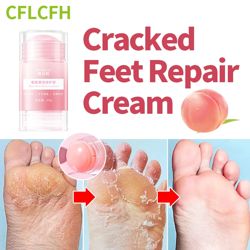 

Anti Crack Foot Cream Drying Cracked Peeling Feet Repair Hand Dead Dry Skin Removal Heel Cracking Moisturizing Care Mask 40g