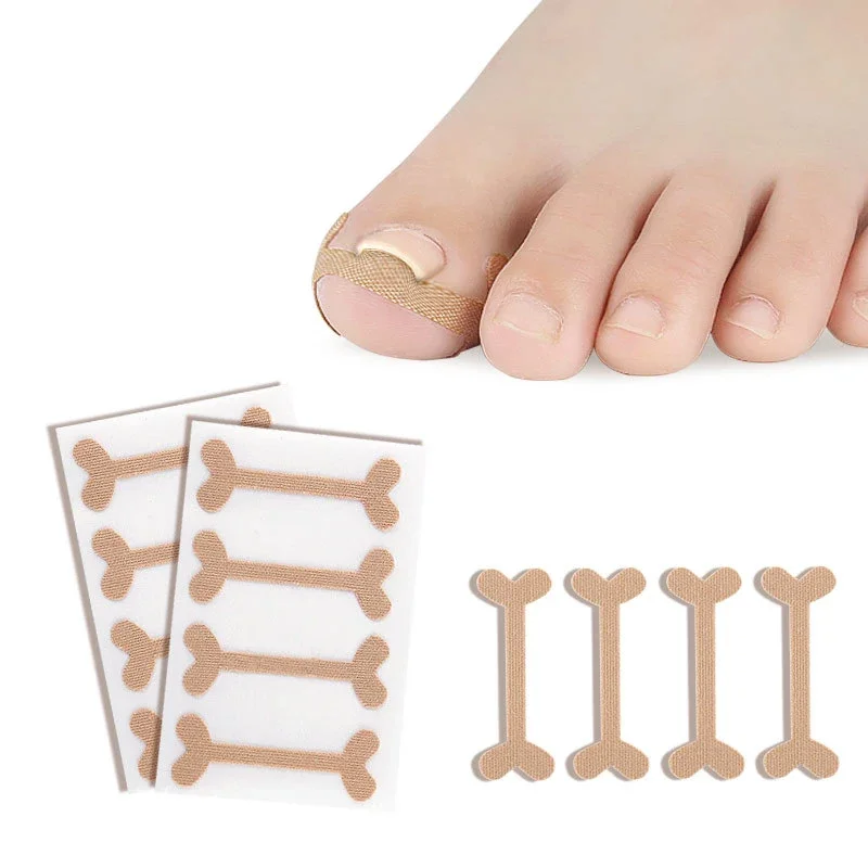 1 Juego de herramientas correctoras de uñas de los pies profesionales, herramienta de corrección para el cuidado de los pies, recuperación de pedicura, tratamiento de uñas de los pies incorporado