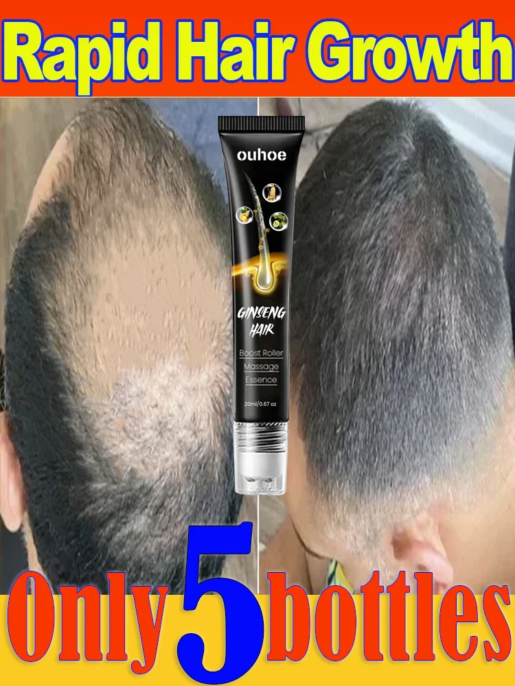 

gray hair Killer;Natural Color/ Anti Gray ʜᴀɪʀ & Darkening Hair | Nourishing ʜᴀɪʀCare Remedy