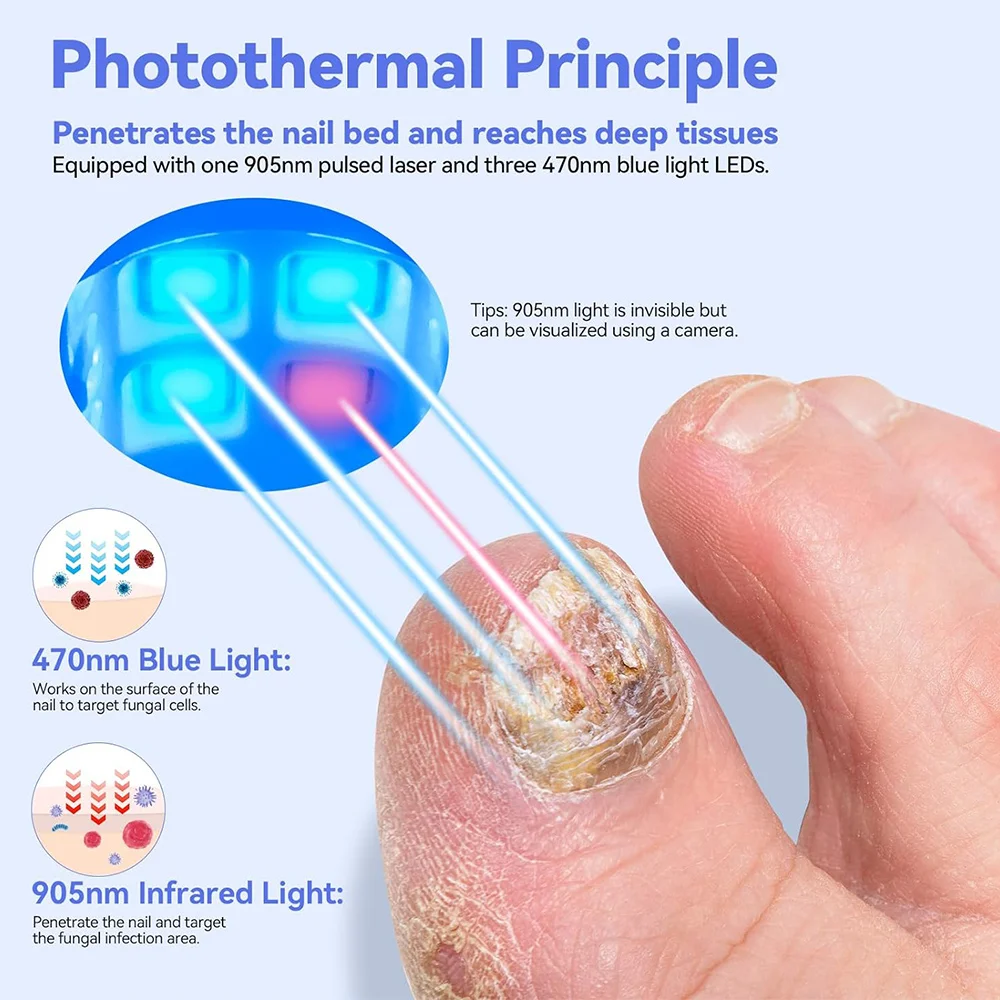أداة مساعدة الأظافر الرمادية المحمولة ، جهاز ليزر لتنظيف الفطريات بالأشعة تحت البنفسجية احترافي للأظافر ، مصباح علاج ضوئي ، شحن من النوع C ، بالجملة