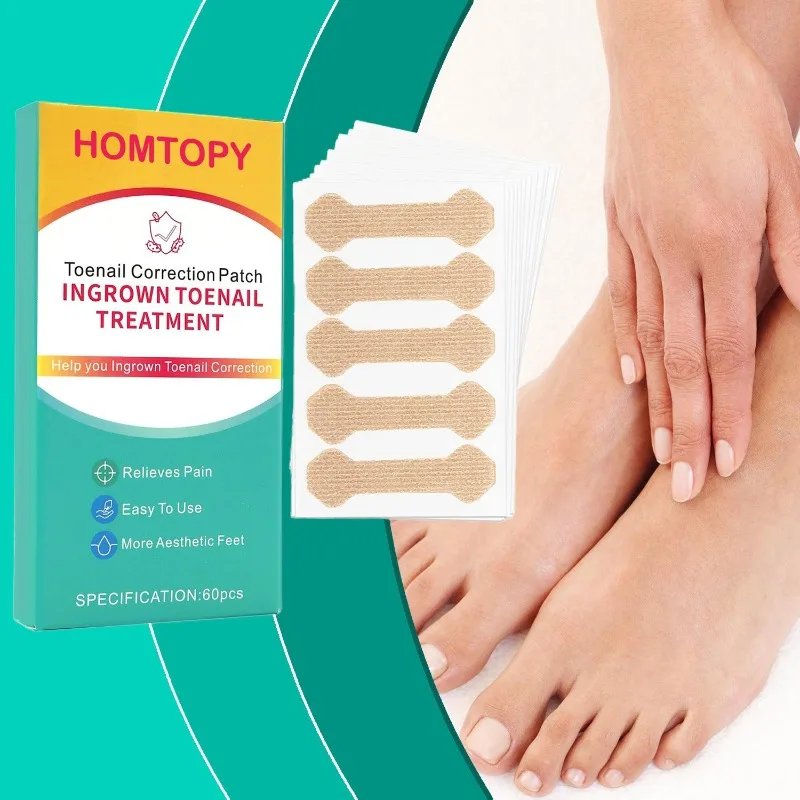Ingrown Toenail Correction Patch Professional Paronychia Repair Sticker Elastic Nail Straightening Strip Relieve Inward Growth