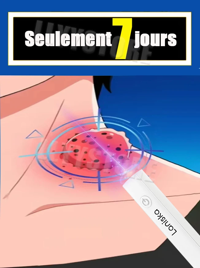 

Лазерная ручка для глубокой стерилизации для безболезненного физического удаления проблем кожи