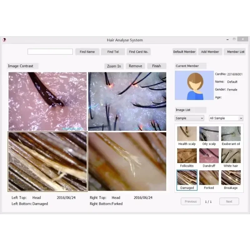 

In stock Hair Skin Iriscope Diagnosis Analyzer with Skin+Iris+Hair Analysis All in 1machine