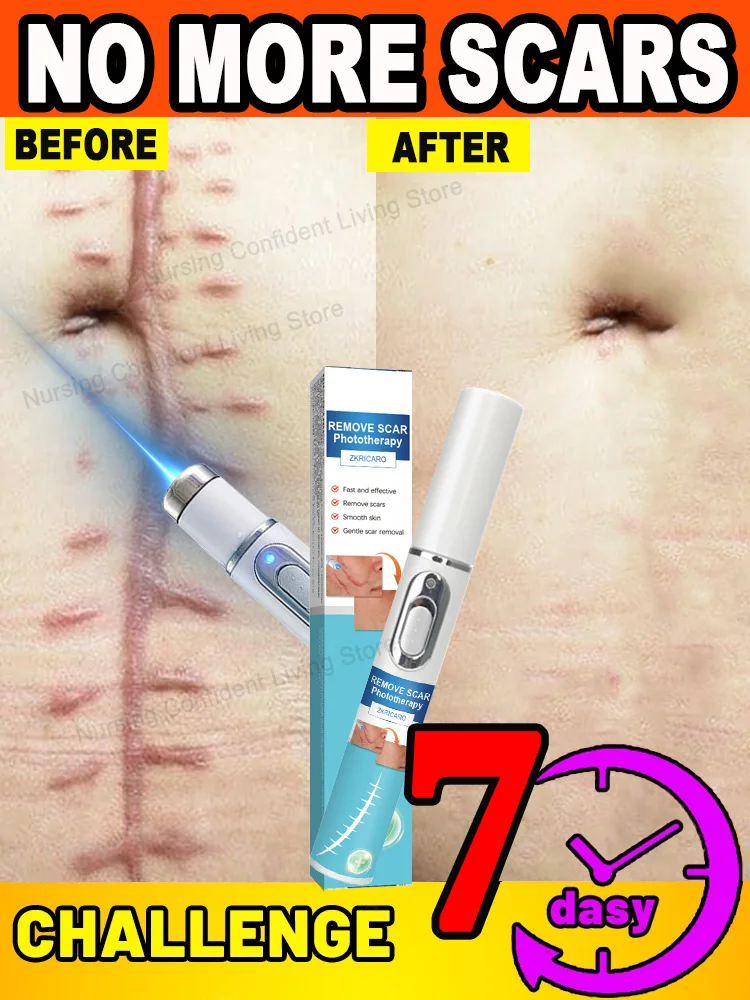 Laser scar repair