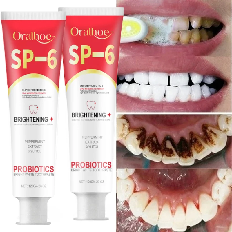 Creme dental probiótico para clareamento dos dentes, SP-6, remove manchas de placa, higiene oral, respiração fresca, Denta, novo, 120g