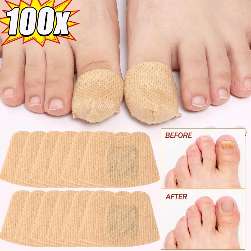 100pcs Fungal Nail Patches Toenail Fungus Treatment Extra Strength – Overnight Nail Care Repair for Damaged Discolored Nails