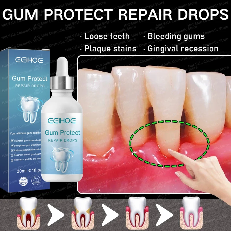 Rapid Damaged Gum Repair Care Serum Relieve Tooth Allergy Dental Caries Tooth Cleaning Toothpaste Relieve Tooth Damage Drops