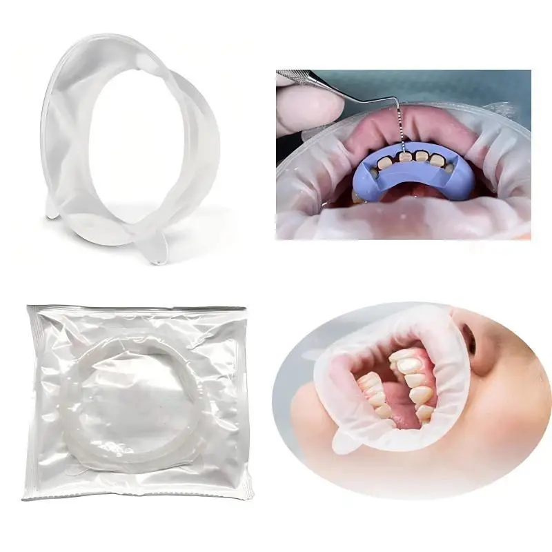 @ Dental Mouth Opener 3D Lip Cheek Retractor O Shape Rubber Expander For Oral Exam And Treatment Procedures