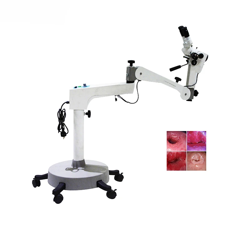 Hot Sale good price and high quality Colposcope for Gynecological Instruments Vaginal Colposcopy Colposcopio