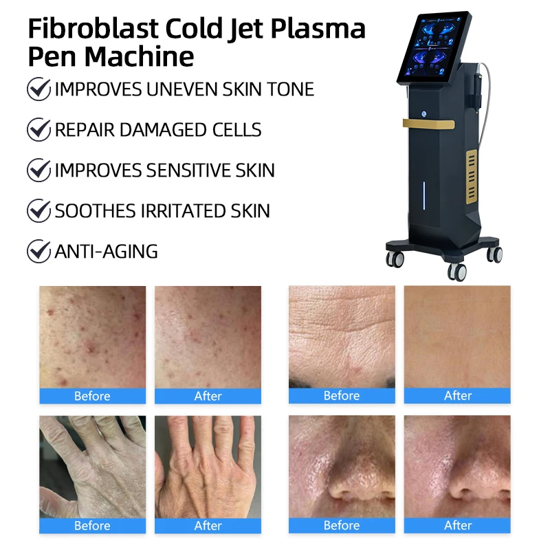 10-in-1 Acne Treatment Collagen Regeneration Fusional Plasma Machine Standing Type LED Indicator US Plug for Beauty Spa