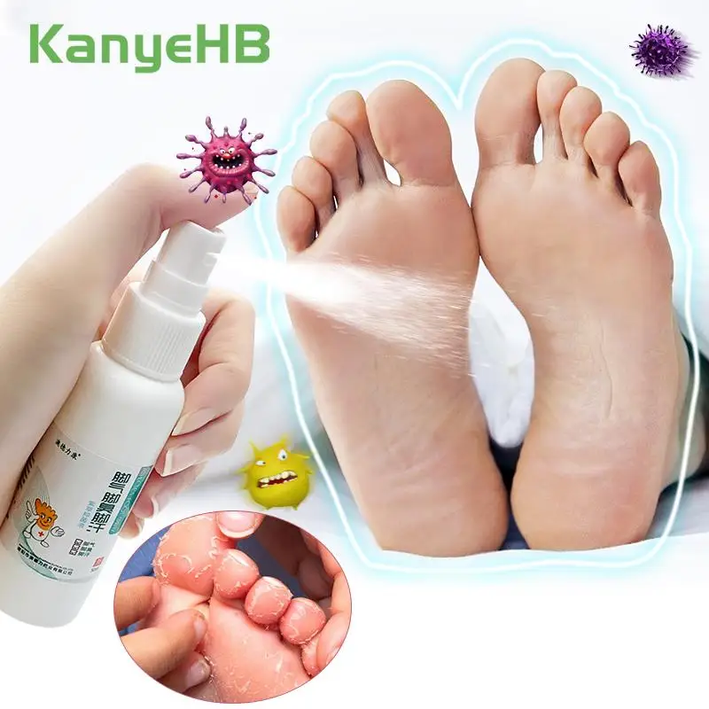 

1-2-4pc Anti Fungal Beriberi Foot Spray Remove Foot Odor Beriberi Itching Foot Care Chinese Herbal Medicine Foot Ointment