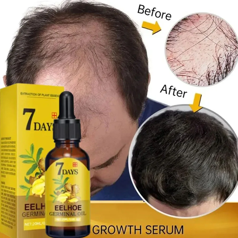 Soro De Crescimento Rápido Do Cabelo De Gengibre, Anti-Loss, Tratamento De Crescimento Do Cabelo, Óleo Essencial, Reparar Raízes De Cabelo Danificado, Produto Do Cuidado Do Cabelo, 7 Dias