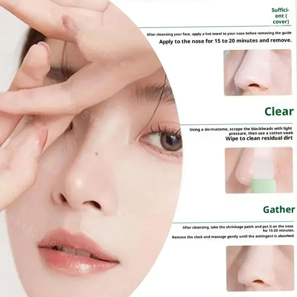 เครื่องมือกำจัดสิวหัวดำและสิวหัวขาวสำหรับจมูกและใบหน้า - เครื่องมือทำความสะอาดรูขุมขนสำหรับดูแลผิวสำหรับทำความสะอาดรูขุมขนด้วยจุดดำ