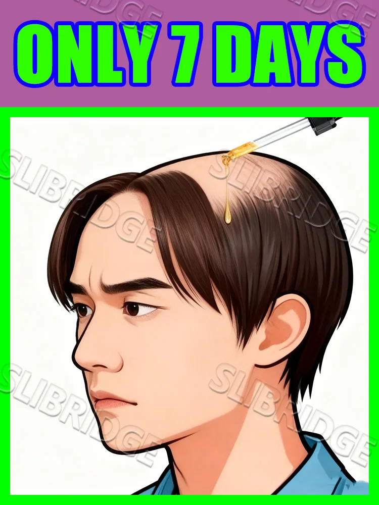 Chaque chute contribue à votre « le règne du volume des cheveux » et est épuisé dans les 7 jours.