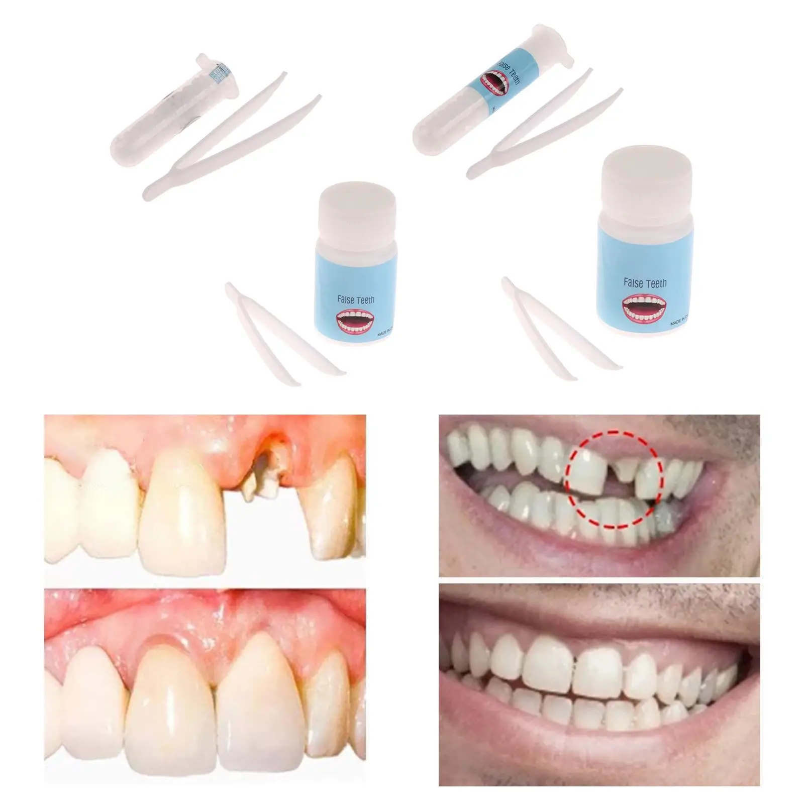 Tooth Repair Denture Adhesive Temporary for Filling The Missing Broken