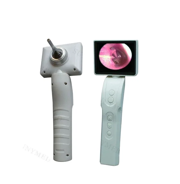 

SY-G046-1 Medical 3 Inch Portable Digital Video Otoscope