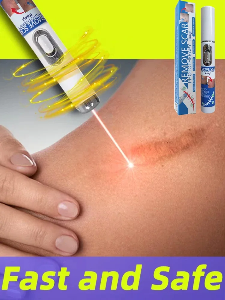 

Pen for scars Safe and Efficient Scar LASER PEN