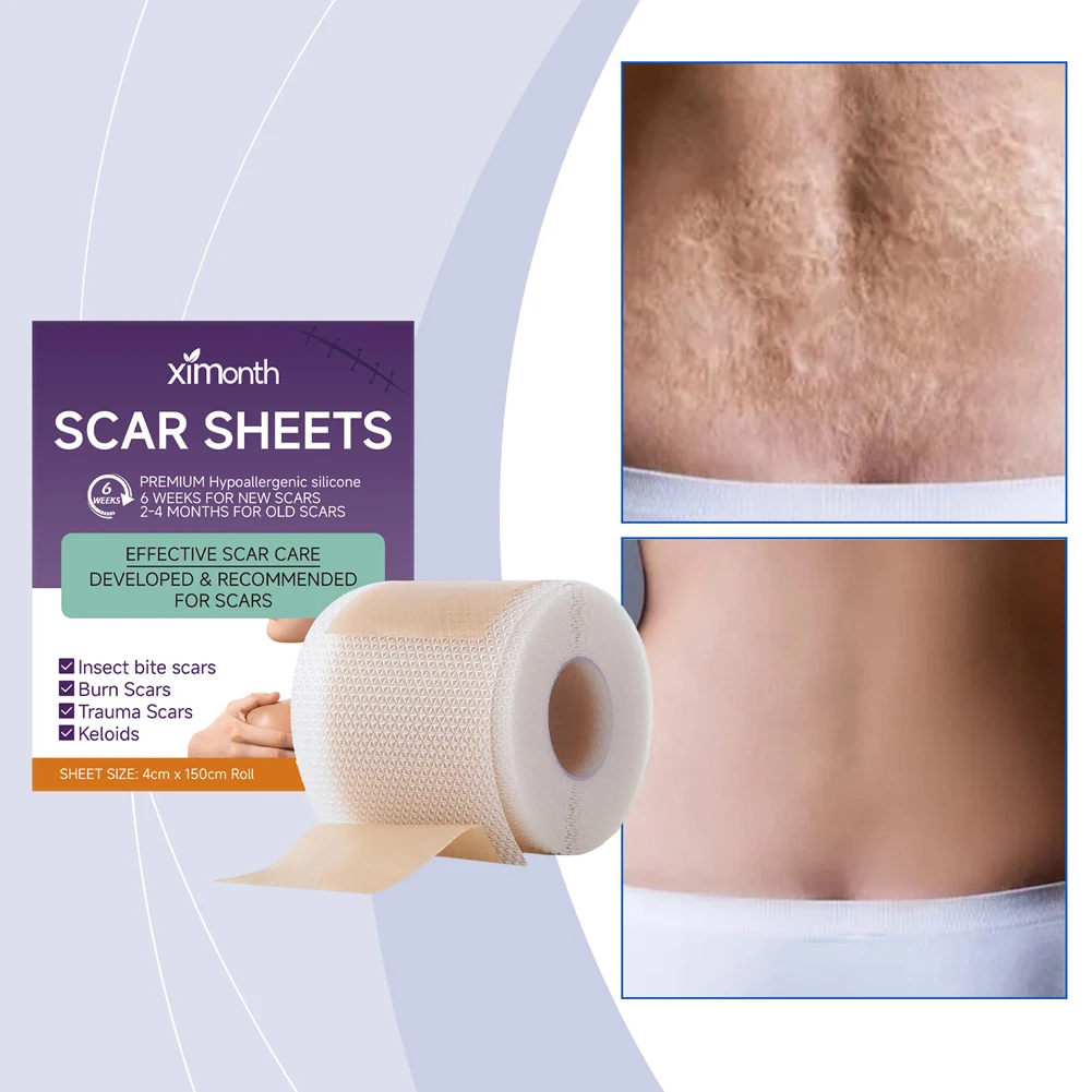 Silicone Scar Sheets Scar Patches Repair Damaged Skin Scars Covers Reduces Redness & Irritation Healing for Burn Keloid Bump