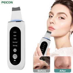 Ultrasonic Skin Scrubber Deep Face Cleaning Peeling Blackhead Remover Ultrasonic Ion Facial Acne Pore Cleanser Lifting Skin Care