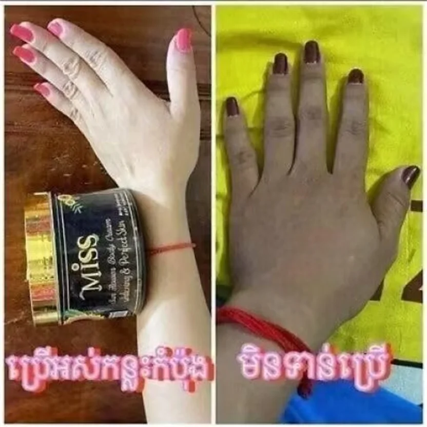 Kemist Thai Original Whitening Body Lotion 400g - Brightening & Hydrating with Authentic Thai Herbal Formula