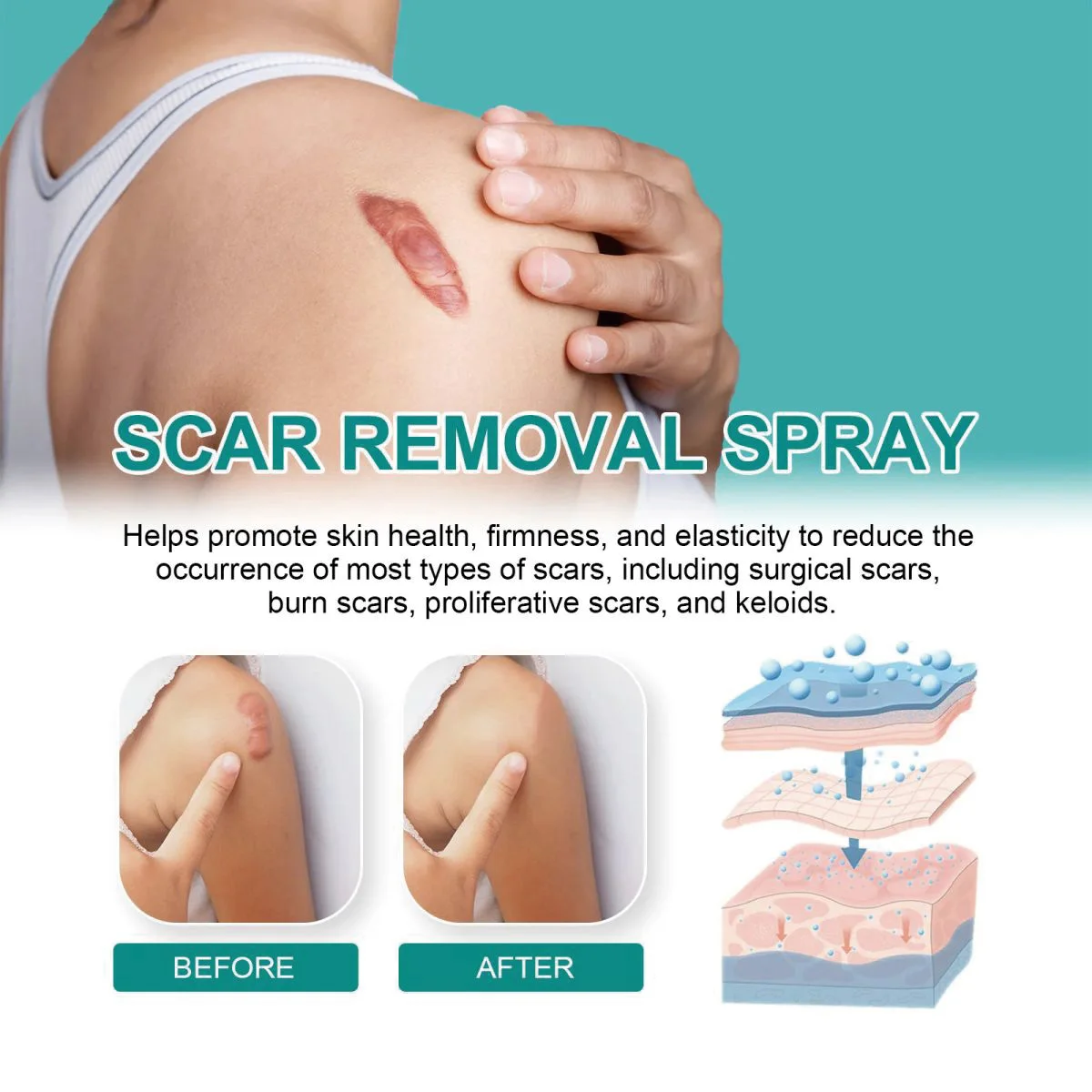 

TRSTAY Эссенция для восстановления шрамов с гиалуроновой кислотой, увлажняющая, осветляющая, гладкая кожа, выцветает шрамы, уход за кожей беременности и беременных