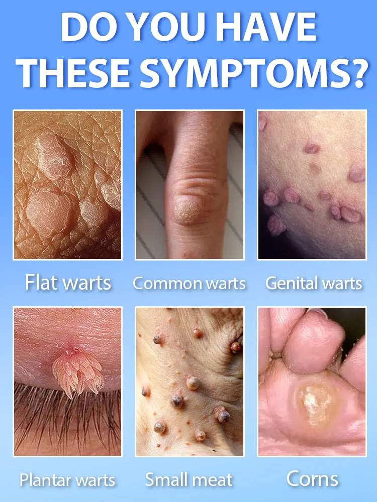 Profesjonalne rozwiązanie na problemy z skórą