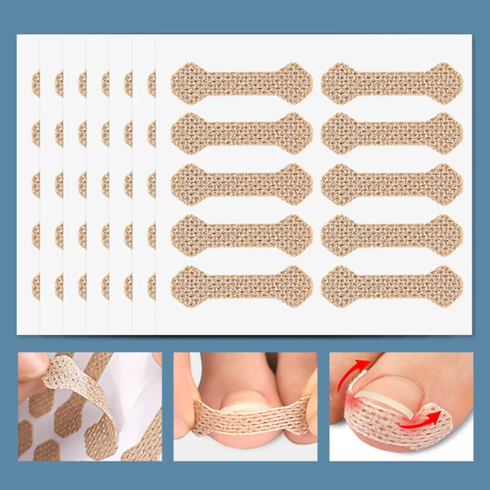 Ingrown Paronychia Toenail Corrector Strips Anti Fungal Nail Correction Stickers Anti Infection Nail Treatment Patch