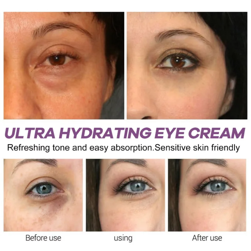 Instant Eye Bag Removal Cream Retinol Anti-Wrinkle Firming Skin Fade Fine Lines Anti Dark Circle Puffiness Brighten Eye Care