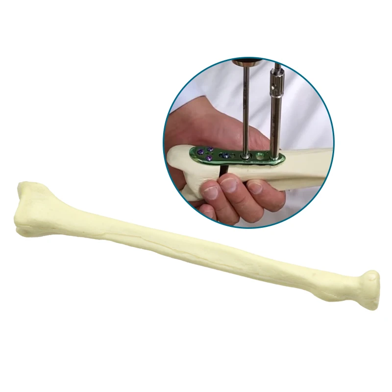 Medical Radius Model Human Bone Anatomy Skeleton Bone Model Learning Model