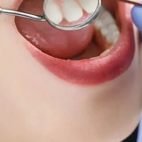 

3Pcs Dentist Hygiene Sickle Shape Scraper Dental Tartar Scaler Calculus Plaque Remover Teeth Cleaning Oral Care