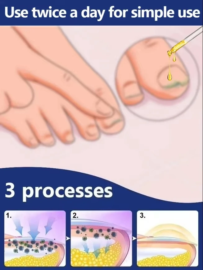 مانيكير للعلبة السيئة في 7 أيام وداع 88 #4