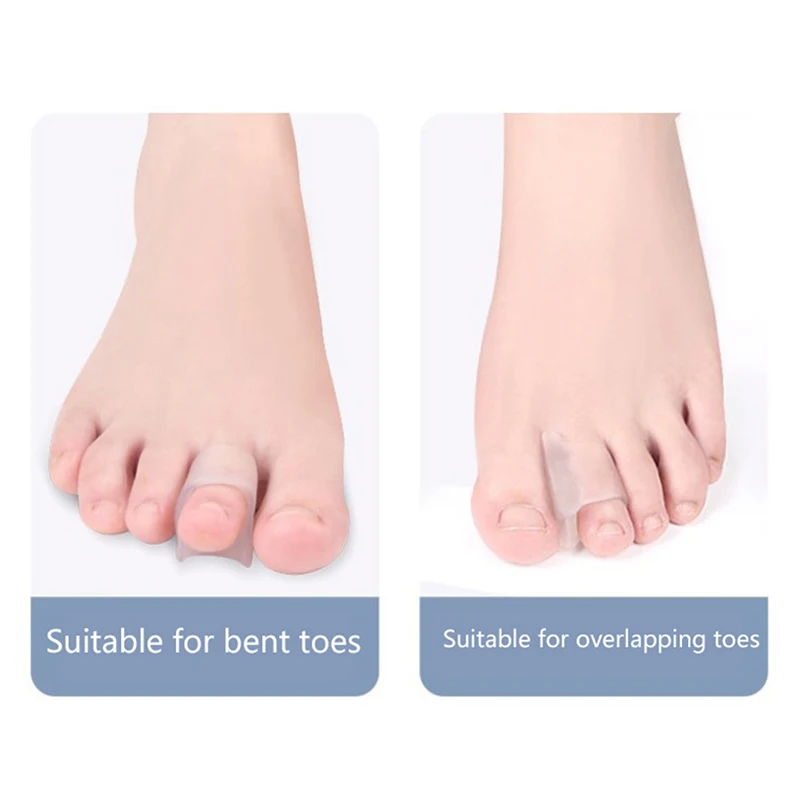 Separador Toe Silicone macio, pé sobreposição corrector, anti-desgaste cuidados almofadas, ferramentas de pedicure, tratar Hallux, Valgus, joanete, 1 par