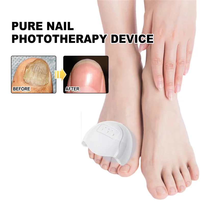 【SURPRISE】Fungal For Nail Treatment Device Lasers For Nail Fungus Onychomycosis Cleaning Foot Repair Fungi Removal Anti Mushroom