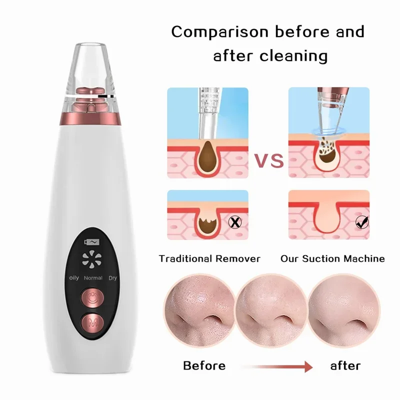 Removedor de cravo facial elétrico, poro de acne a vácuo, remoção de manchas pretas, rosto, limpador profundo do nariz, máquina recarregável USB