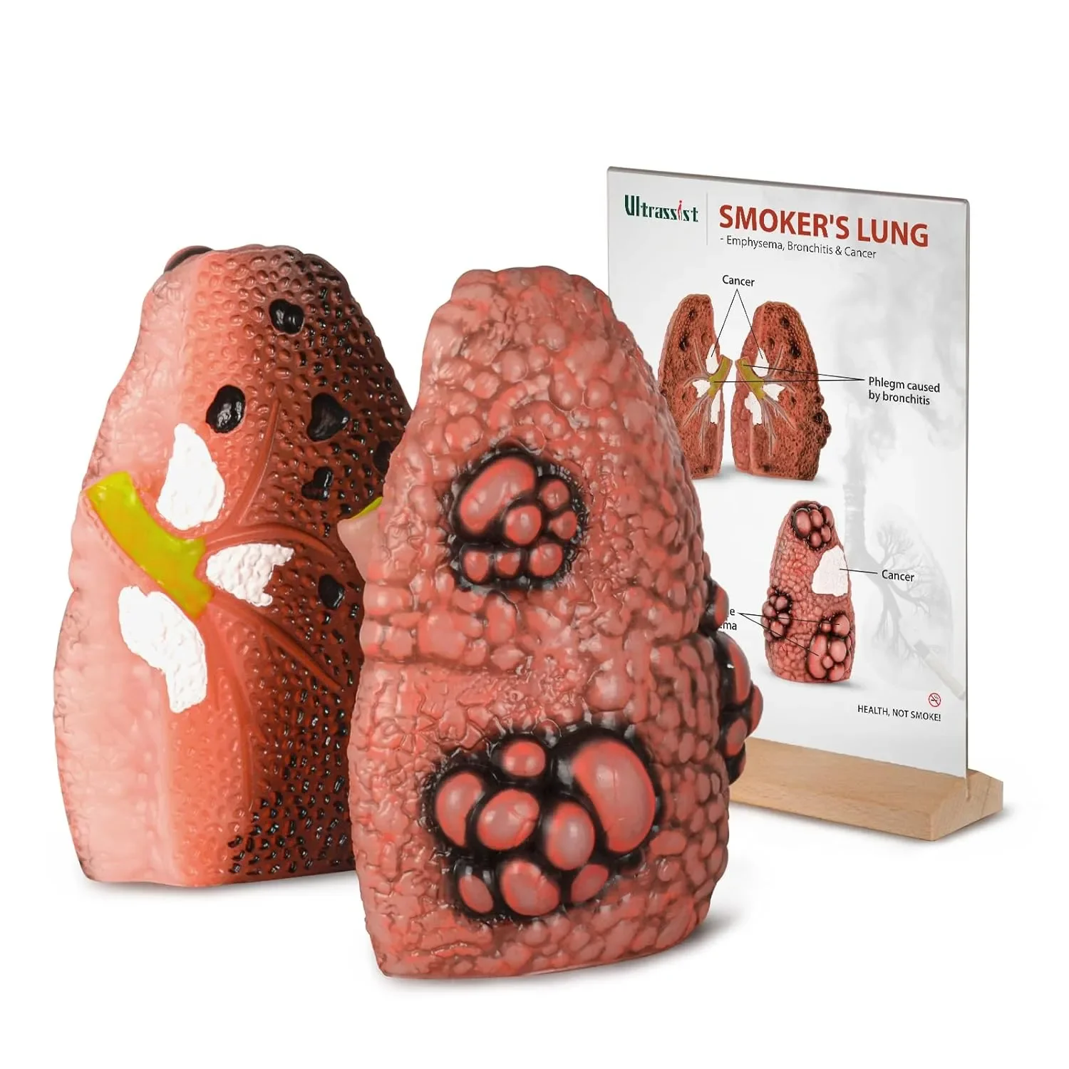 

Ultrassist Cough Up Lung Model for Smoking Education and Lung Anatomy