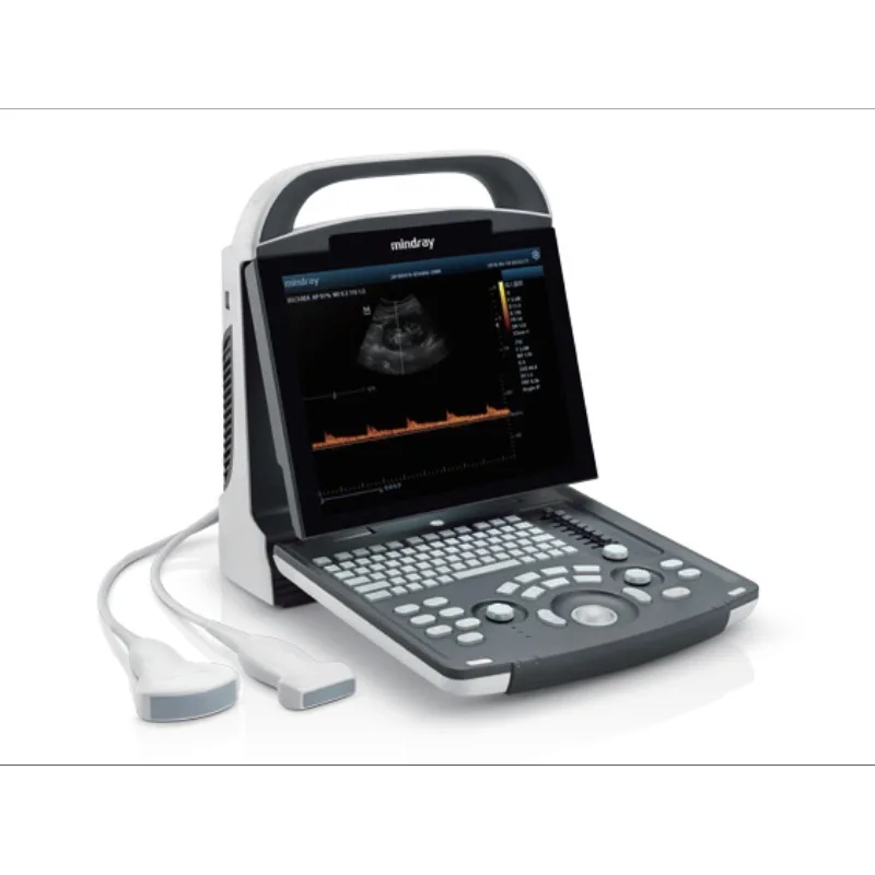 Pregnancy Ultrasoun…