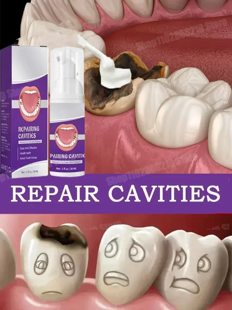 Hot sales Best-selling, Scientific Repairs Cavities, Removes Cavities, Cleans Plaque, Whitens Teeth, and Freshens Breath