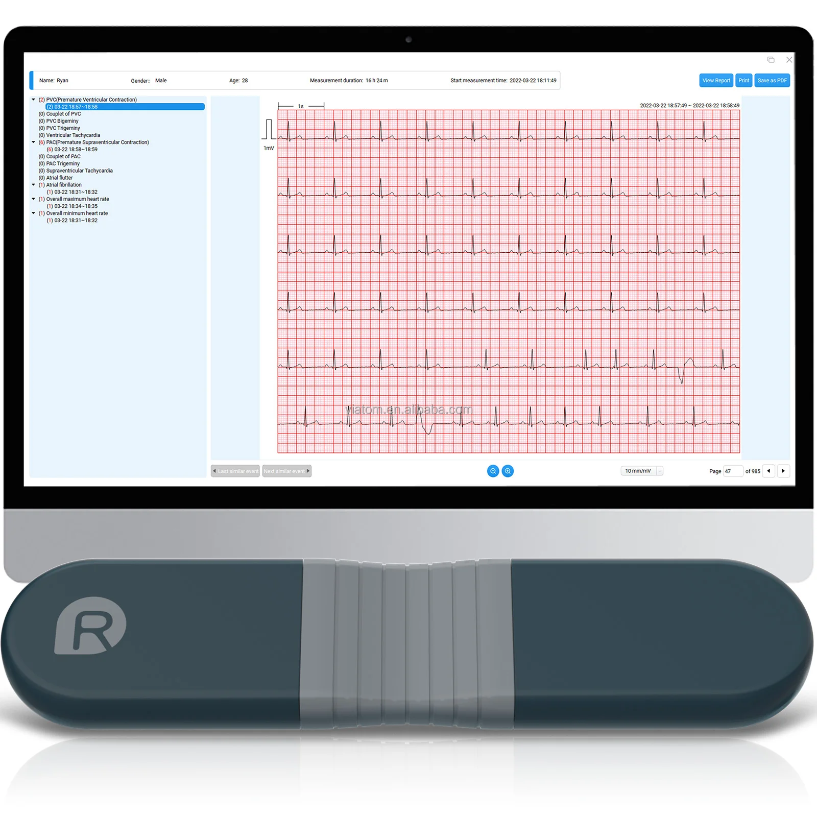 Soluzioni IoT per il monitoraggio remoto del paziente Viatom tramite Gateway di Roaming Bluetooth monitoraggio ECG/ECG 24 ore su 24