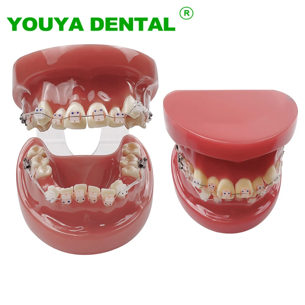 

Dental Orthodontic Model For Patient Communication Dentist Teaching Study Model Ortho Treatment Teeth Model Dentistry Products