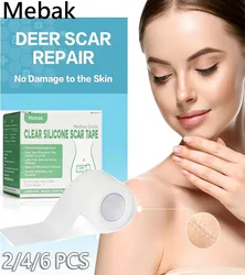 Silicone Scar Sheets Medical Grade Washable Silicone Scar Tape for injuries/insisions Acne Scars C-Section & Keloid Surgery Scar