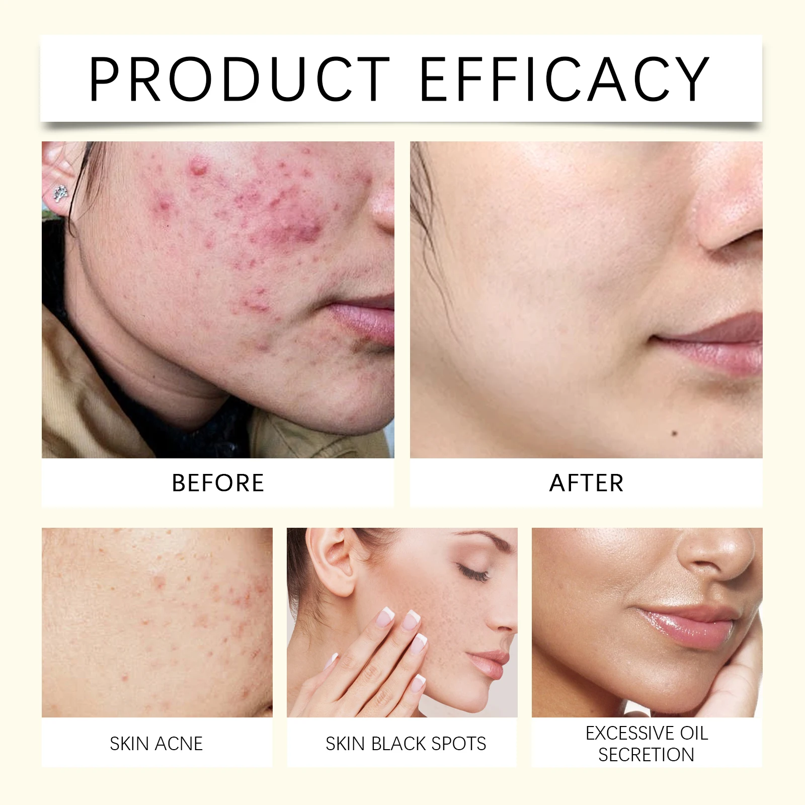 Savon au curcuma naturel fait à la main, 100g, soins pour le visage, beauté, nettoyage du corps, éclaircissant, aisselles, jambes, soins pour la peau