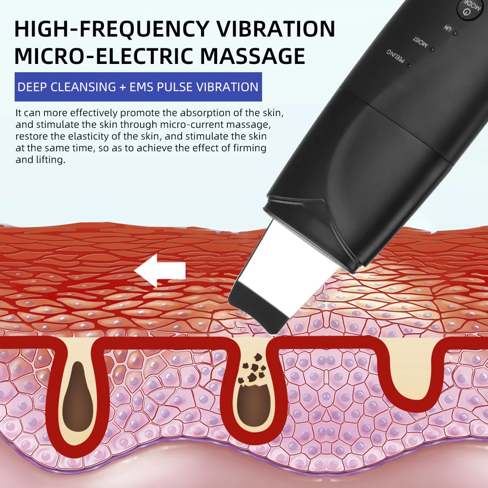 超sonicスキンスクラバー顔マッサージにきび除去毛穴クリーナーディープフェイスケアsonic剥離装置