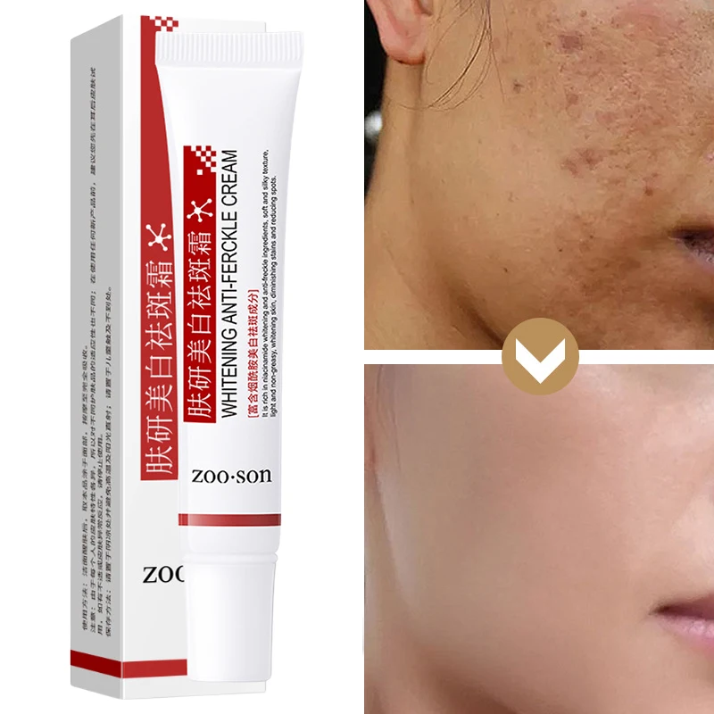 

Niacinamide Face Whitening Cream Dark Spots Freckles Remover Anti-wrinkle Facial Moisturizer Brighten Skin Care Korean Cosmetics